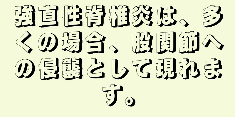 強直性脊椎炎は、多くの場合、股関節への侵襲として現れます。