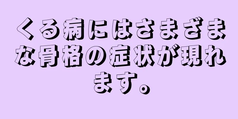 くる病にはさまざまな骨格の症状が現れます。