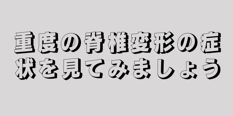 重度の脊椎変形の症状を見てみましょう
