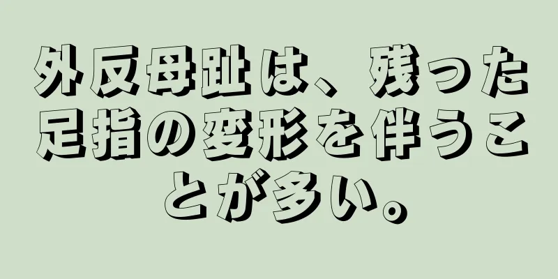 外反母趾は、残った足指の変形を伴うことが多い。
