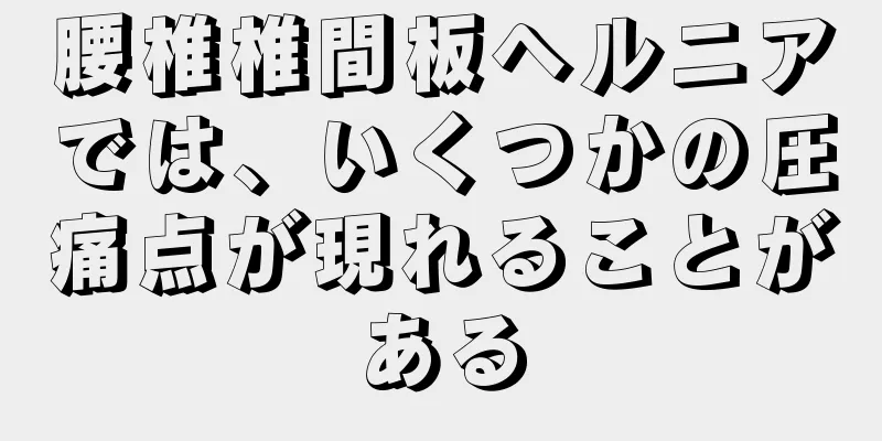 腰椎椎間板ヘルニアでは、いくつかの圧痛点が現れることがある
