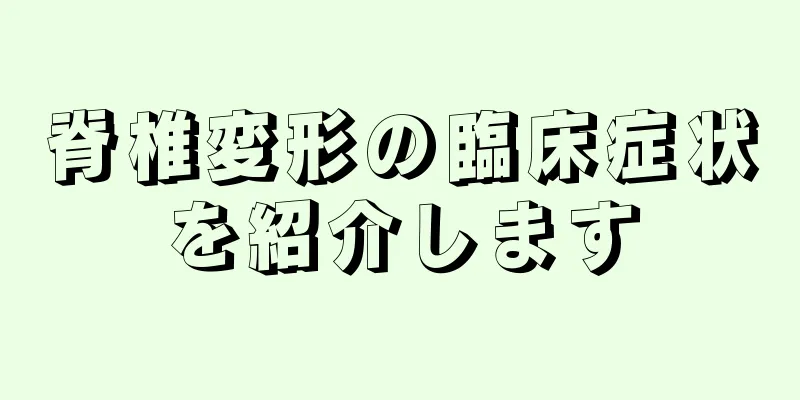 脊椎変形の臨床症状を紹介します
