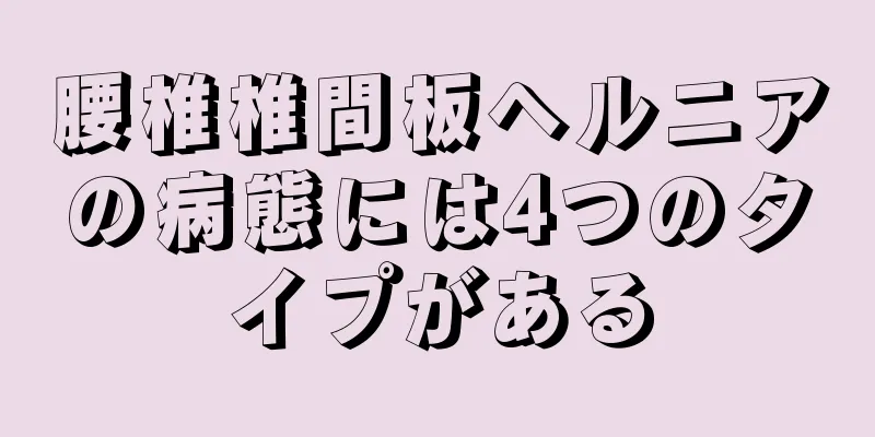 腰椎椎間板ヘルニアの病態には4つのタイプがある