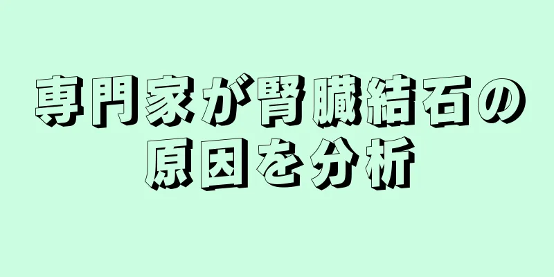 専門家が腎臓結石の原因を分析