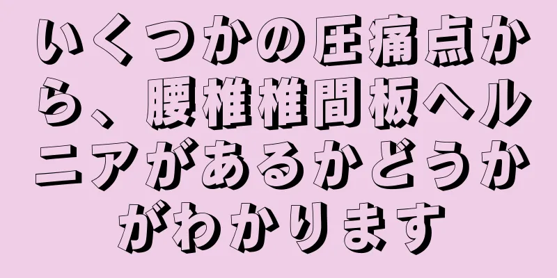 いくつかの圧痛点から、腰椎椎間板ヘルニアがあるかどうかがわかります