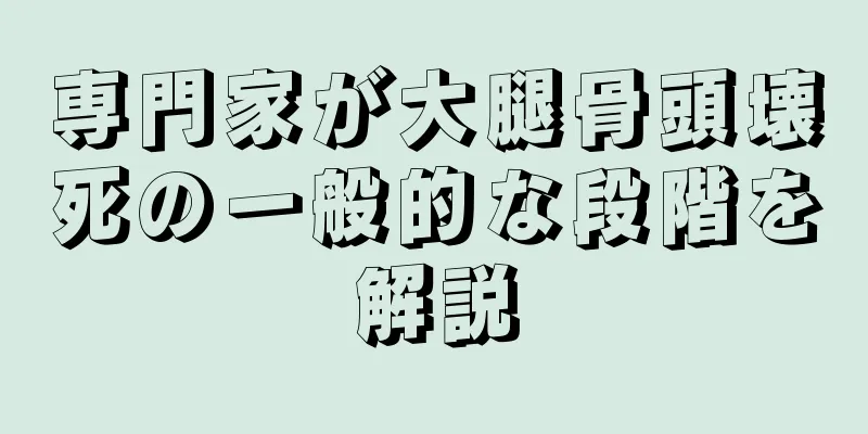 専門家が大腿骨頭壊死の一般的な段階を解説