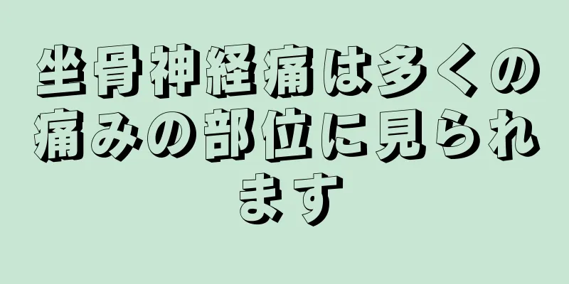 坐骨神経痛は多くの痛みの部位に見られます