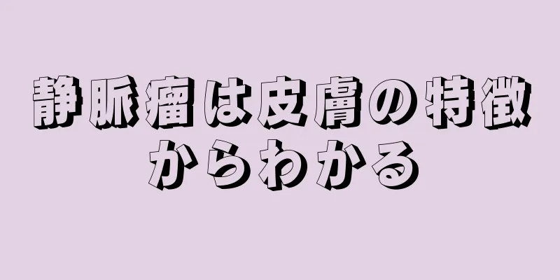 静脈瘤は皮膚の特徴からわかる
