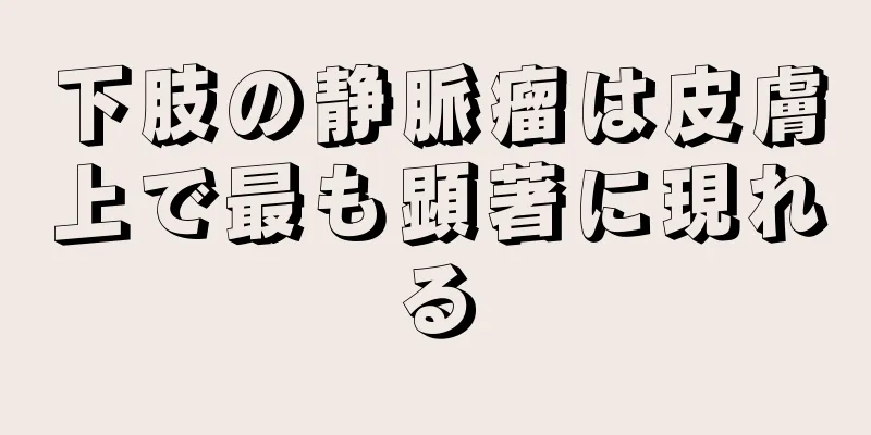 下肢の静脈瘤は皮膚上で最も顕著に現れる