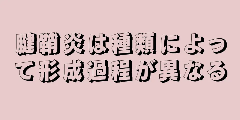 腱鞘炎は種類によって形成過程が異なる