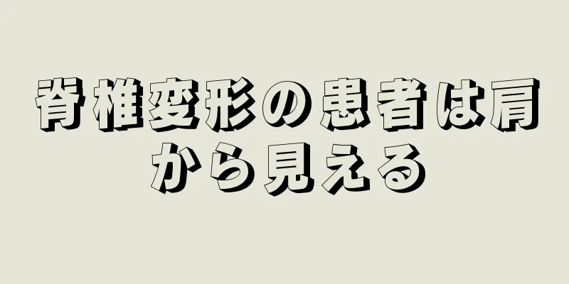 脊椎変形の患者は肩から見える