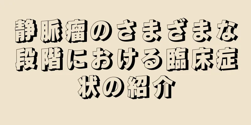 静脈瘤のさまざまな段階における臨床症状の紹介