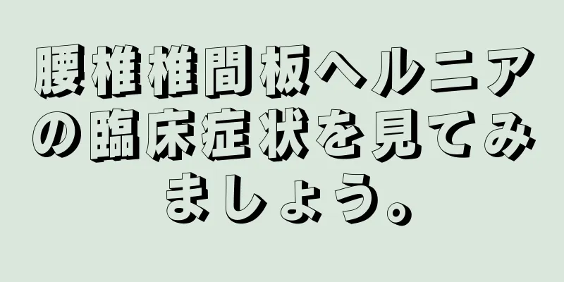 腰椎椎間板ヘルニアの臨床症状を見てみましょう。
