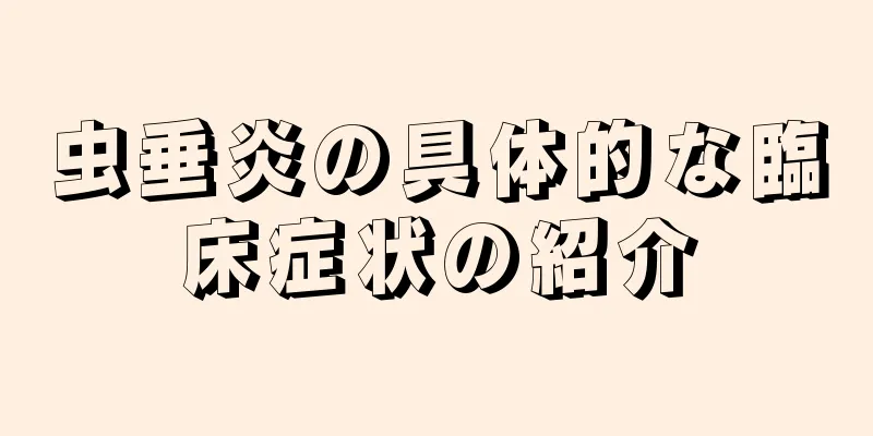 虫垂炎の具体的な臨床症状の紹介