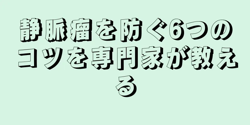 静脈瘤を防ぐ6つのコツを専門家が教える