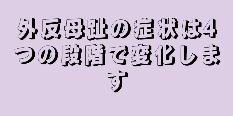 外反母趾の症状は4つの段階で変化します