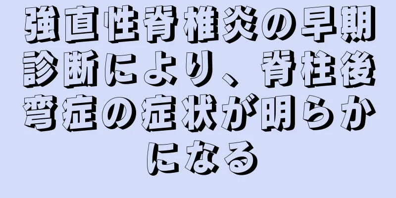 強直性脊椎炎の早期診断により、脊柱後弯症の症状が明らかになる
