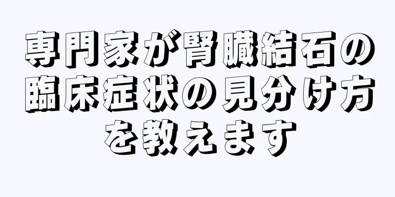 専門家が腎臓結石の臨床症状の見分け方を教えます