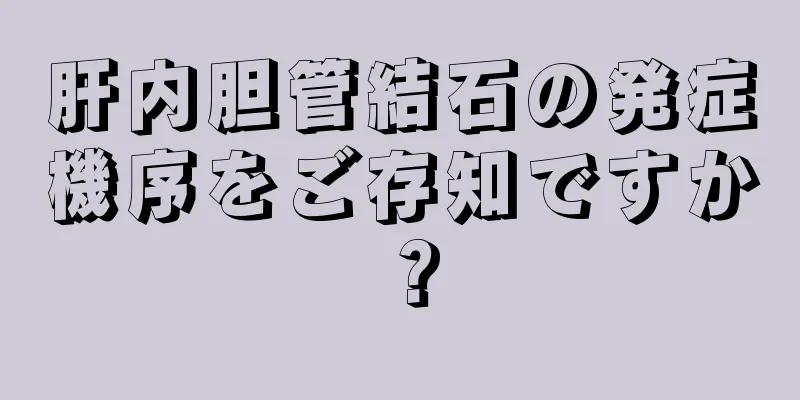 肝内胆管結石の発症機序をご存知ですか？
