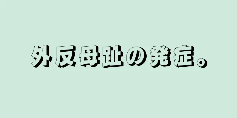 外反母趾の発症。