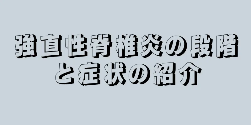 強直性脊椎炎の段階と症状の紹介