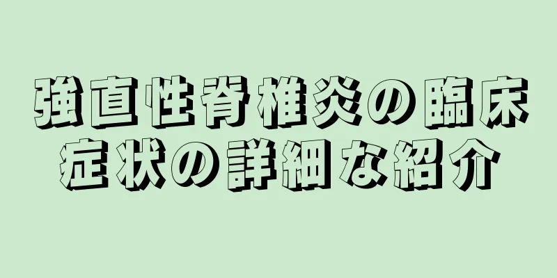 強直性脊椎炎の臨床症状の詳細な紹介