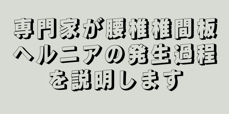 専門家が腰椎椎間板ヘルニアの発生過程を説明します