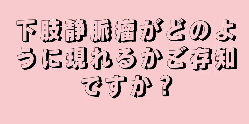 下肢静脈瘤がどのように現れるかご存知ですか？