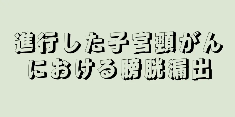 進行した子宮頸がんにおける膀胱漏出