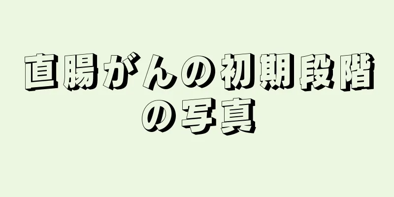 直腸がんの初期段階の写真