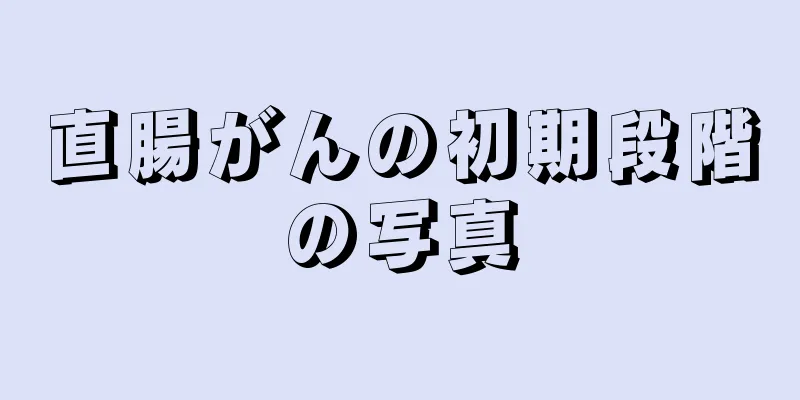 直腸がんの初期段階の写真
