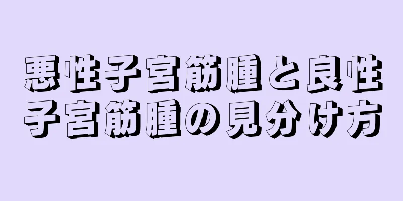 悪性子宮筋腫と良性子宮筋腫の見分け方