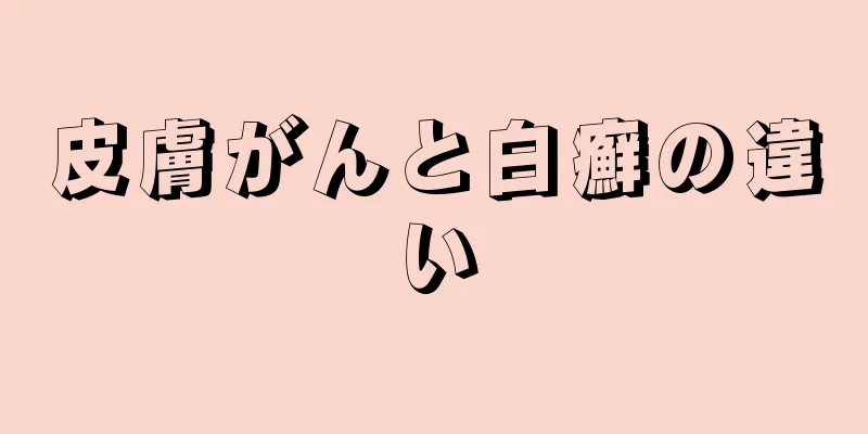 皮膚がんと白癬の違い
