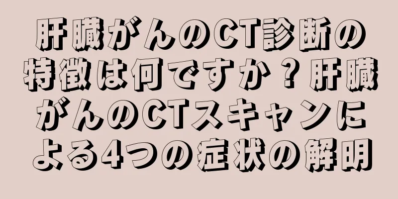 肝臓がんのCT診断の特徴は何ですか？肝臓がんのCTスキャンによる4つの症状の解明