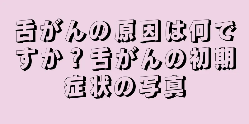 舌がんの原因は何ですか？舌がんの初期症状の写真