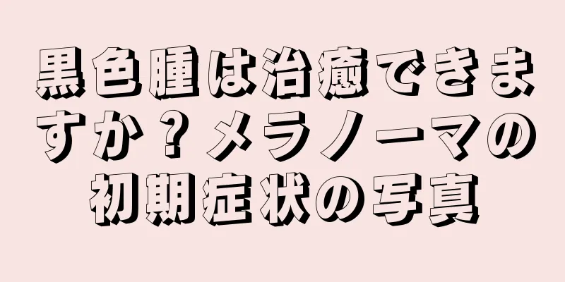 黒色腫は治癒できますか？メラノーマの初期症状の写真