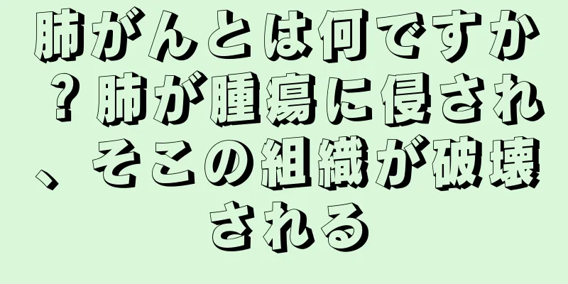 肺がんとは何ですか？肺が腫瘍に侵され、そこの組織が破壊される