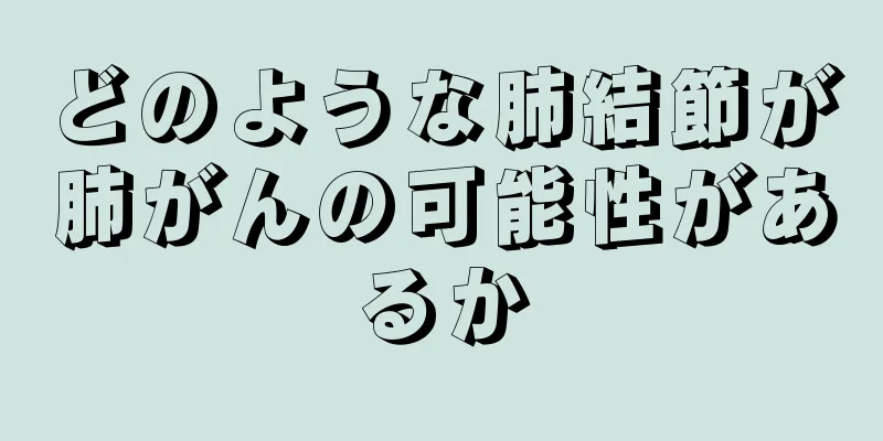 どのような肺結節が肺がんの可能性があるか