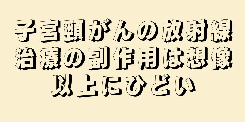 子宮頸がんの放射線治療の副作用は想像以上にひどい