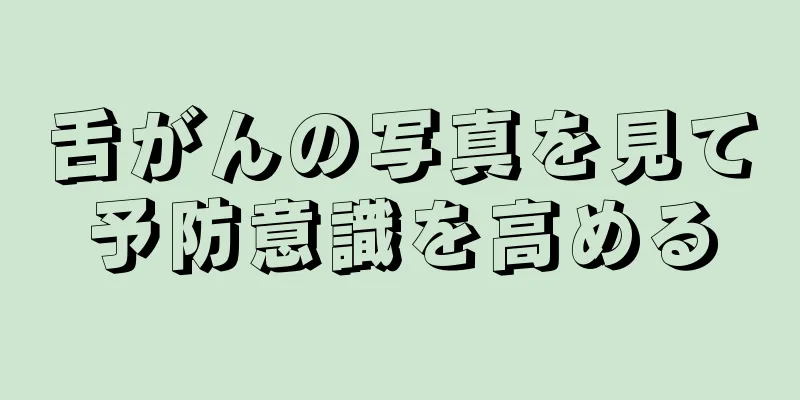 舌がんの写真を見て予防意識を高める