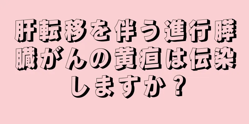 肝転移を伴う進行膵臓がんの黄疸は伝染しますか？