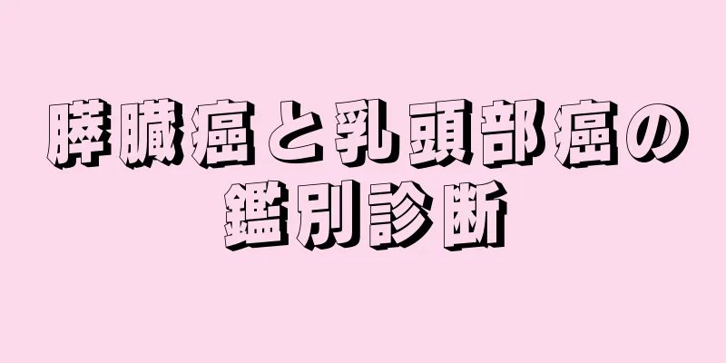 膵臓癌と乳頭部癌の鑑別診断