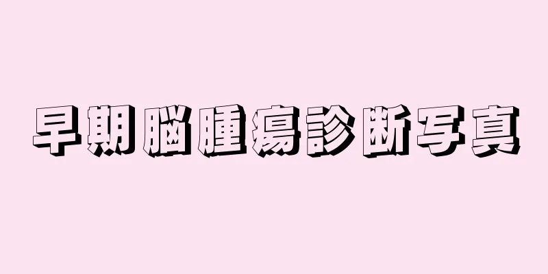 早期脳腫瘍診断写真