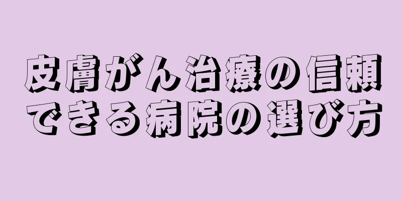 皮膚がん治療の信頼できる病院の選び方