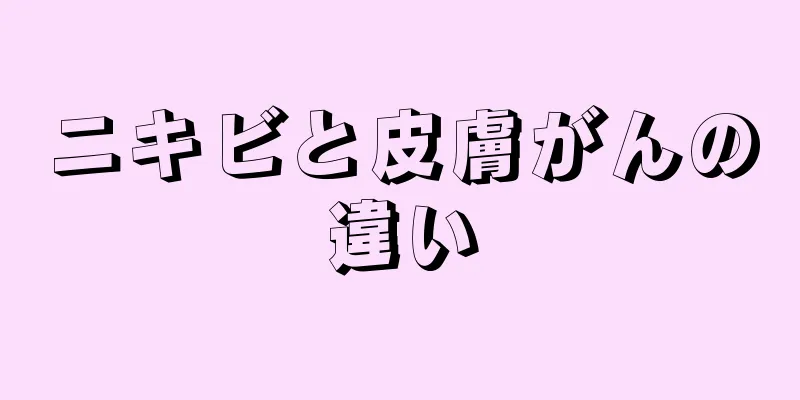 ニキビと皮膚がんの違い