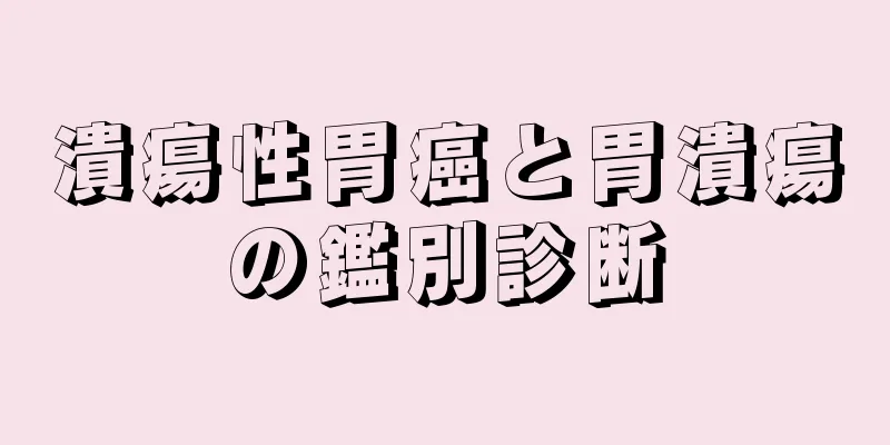 潰瘍性胃癌と胃潰瘍の鑑別診断