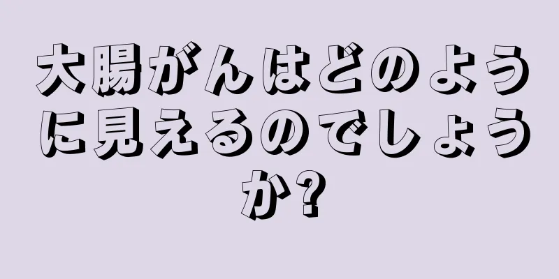 大腸がんはどのように見えるのでしょうか?