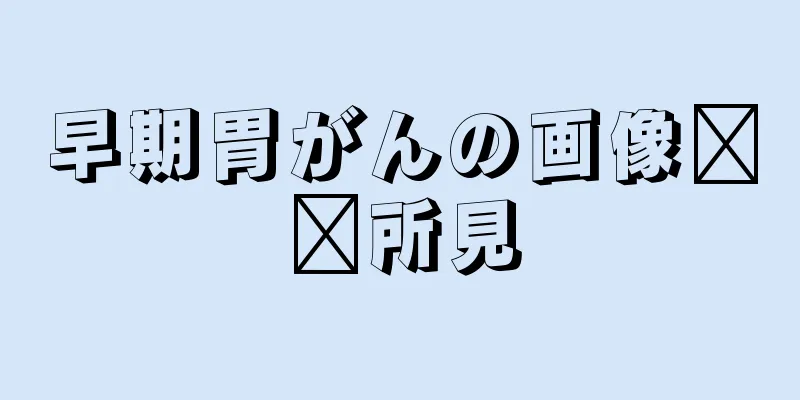 早期胃がんの画像​​所見