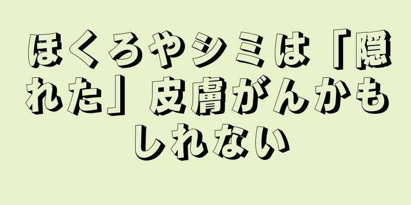 ほくろやシミは「隠れた」皮膚がんかもしれない