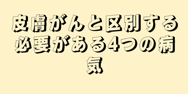 皮膚がんと区別する必要がある4つの病気